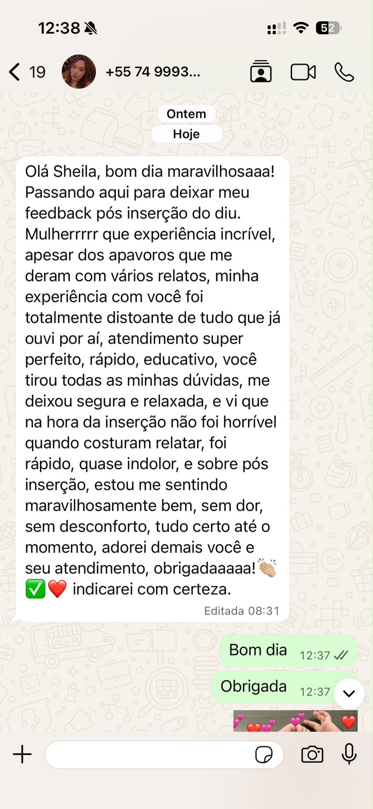 Depoimento de paciente sobre inserção do DIU